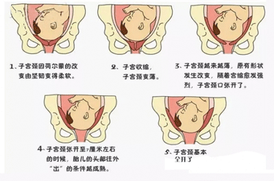 关于胎头入盆后多久会生 你了解吗